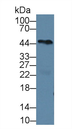Western Blot; Sample: Recombinant protein.
