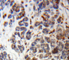 Proopiomelanocortin (POMC) Polyclonal Antibody - image 3