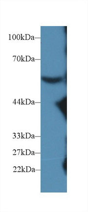 Western Blot; Sample: Recombinant protein.