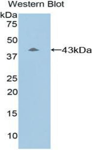 DAB staining on IHC-P; Samples: Mouse Liver Tissue;  Primary Ab: 20μg/ml Rabbit Anti-Mouse C8b Antibody Second Ab: 2µg/mL HRP-Linked Caprine Anti-Rabbit IgG Polyclonal Antibody