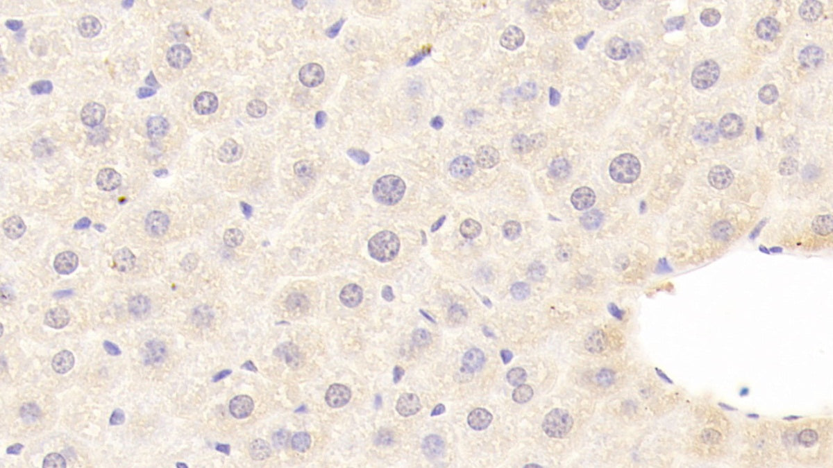 Complement Component 8b (C8b) Polyclonal Antibody - image 4