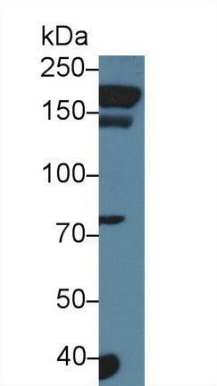 Western Blot; Sample: Recombinant protein.