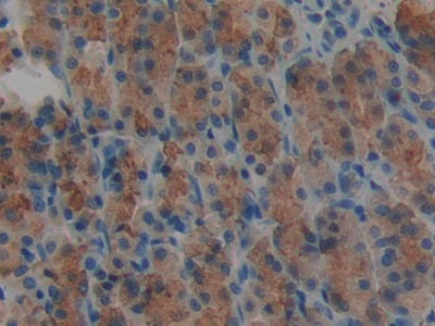 Agrin (AGRN) Polyclonal Antibody - image 5
