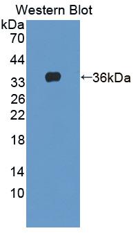 Agrin (AGRN) Polyclonal Antibody - image 2