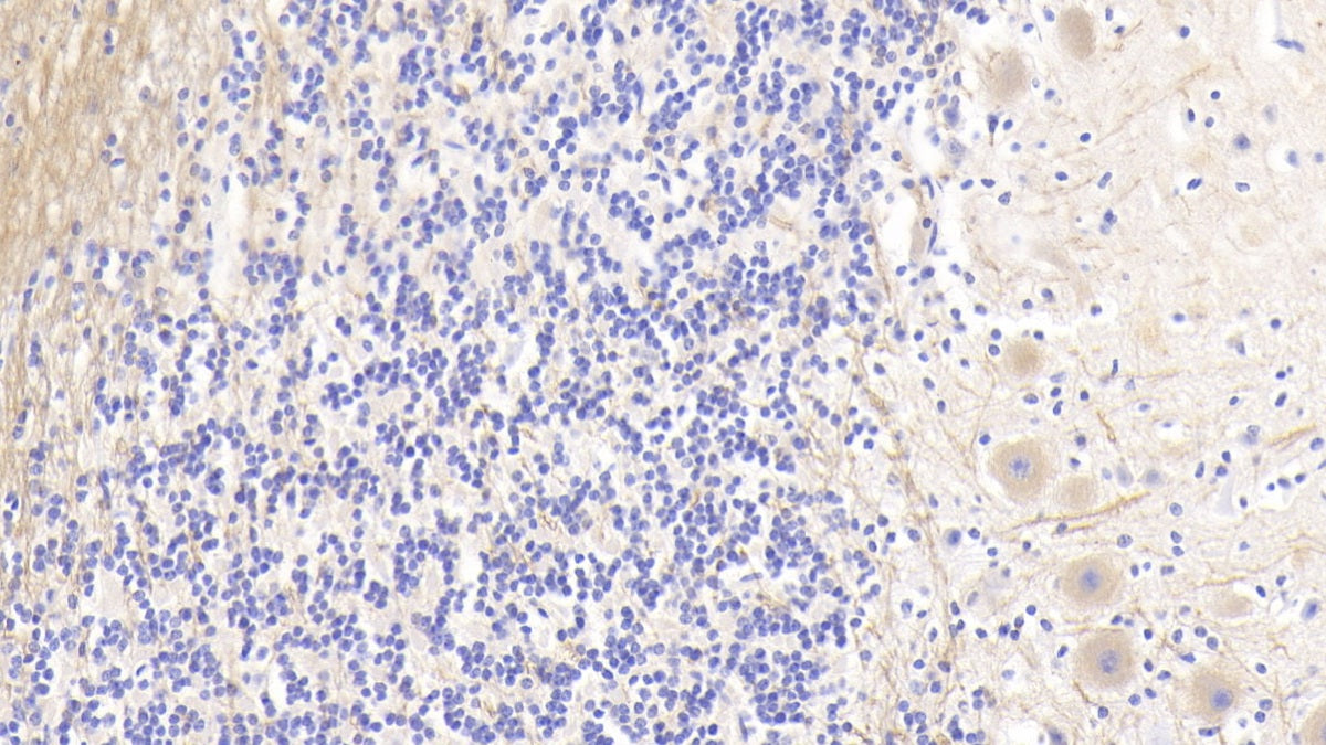 Agrin (AGRN) Polyclonal Antibody - image 3