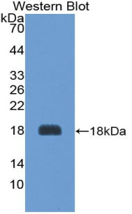 Agouti Related Protein (AGRP) Polyclonal Antibody - image 2