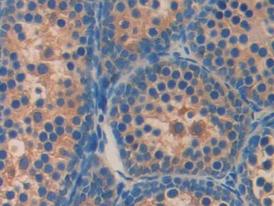 DAB staining on fromalin fixed paraffin- embedded heart tissue)
