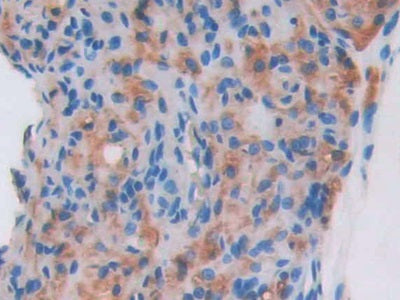Agouti Related Protein (AGRP) Polyclonal Antibody - image 4