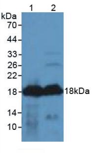 Western Blot; Sample: Recombinant AGRP, Human.