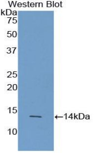 DAB staining on IHC-P; Samples: Human Cerebrum Tissue;  Primary Ab: 20µg/ml Rabbit Anti-Human AGRP Antibody Second Ab: 2µg/mL HRP-Linked Caprine Anti-Rabbit IgG Polyclonal Antibody