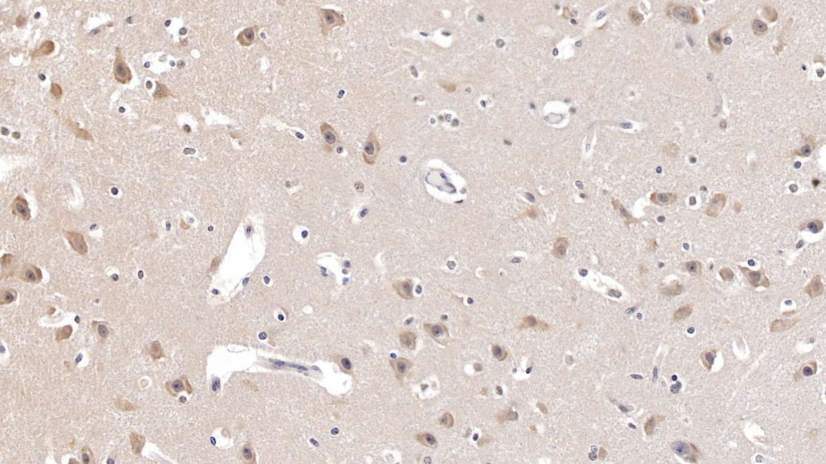 Agouti Related Protein (AGRP) Polyclonal Antibody - image 4