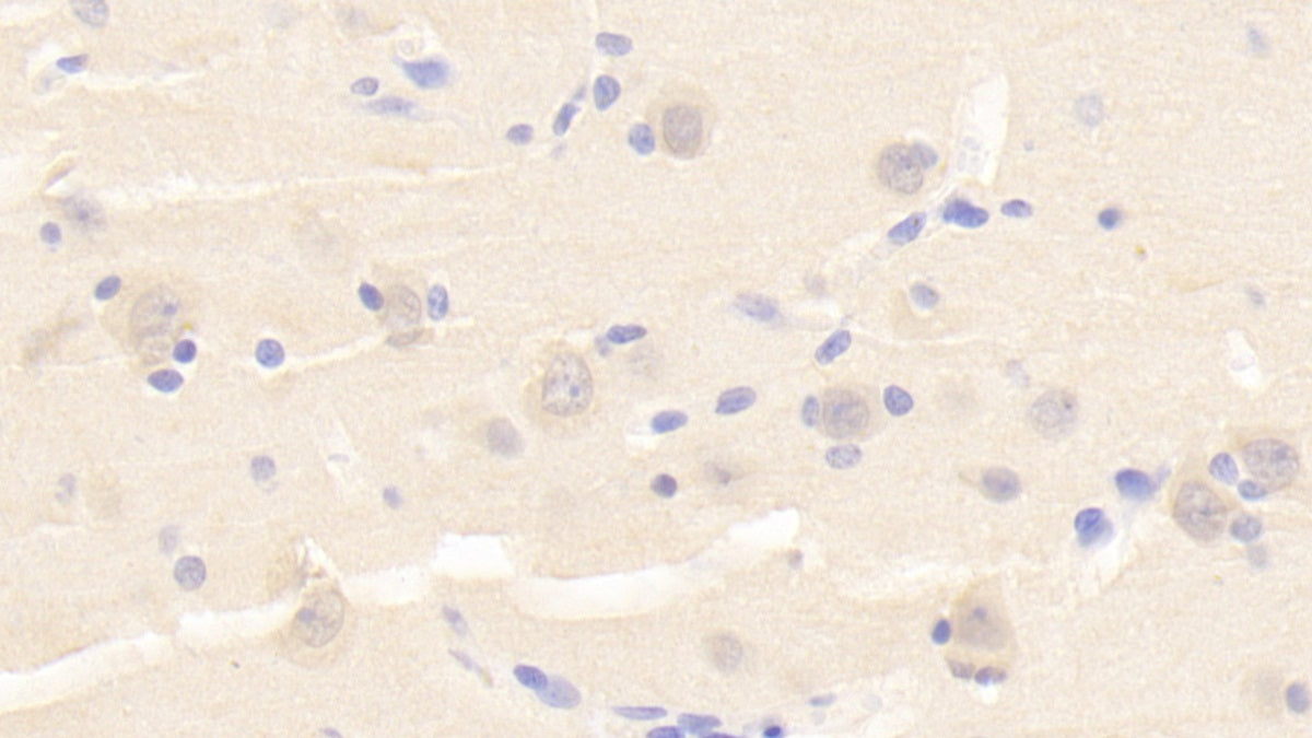 Protein Tyrosine Phosphatase Receptor Type S (PTPRS) Polyclonal Antibody - image 3