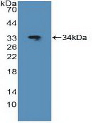 Used in DAB staining on fromalin fixed paraffin-embedded Ovary tissue
