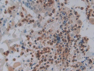 V-Fos FBJ Murine Osteosarcoma Viral Oncogene Homolog (FOS) Polyclonal Antibody - image 4