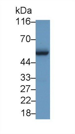 Western Blot; Sample: HL60 cell lysate; Primary Ab: 3μg/ml Rabbit Anti-Mouse MYC Antibody; Second Ab: 0.2µg/mL HRP-Linked Caprine Anti-Rabbit IgG Polyclonal Antibody;