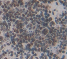 V-Myc Myelocytomatosis Viral Oncogene Homolog (MYC) Polyclonal Antibody - image 4