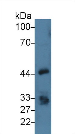 Epithelial Cell Adhesion Molecule (EPCAM) Polyclonal Antibody - image 2