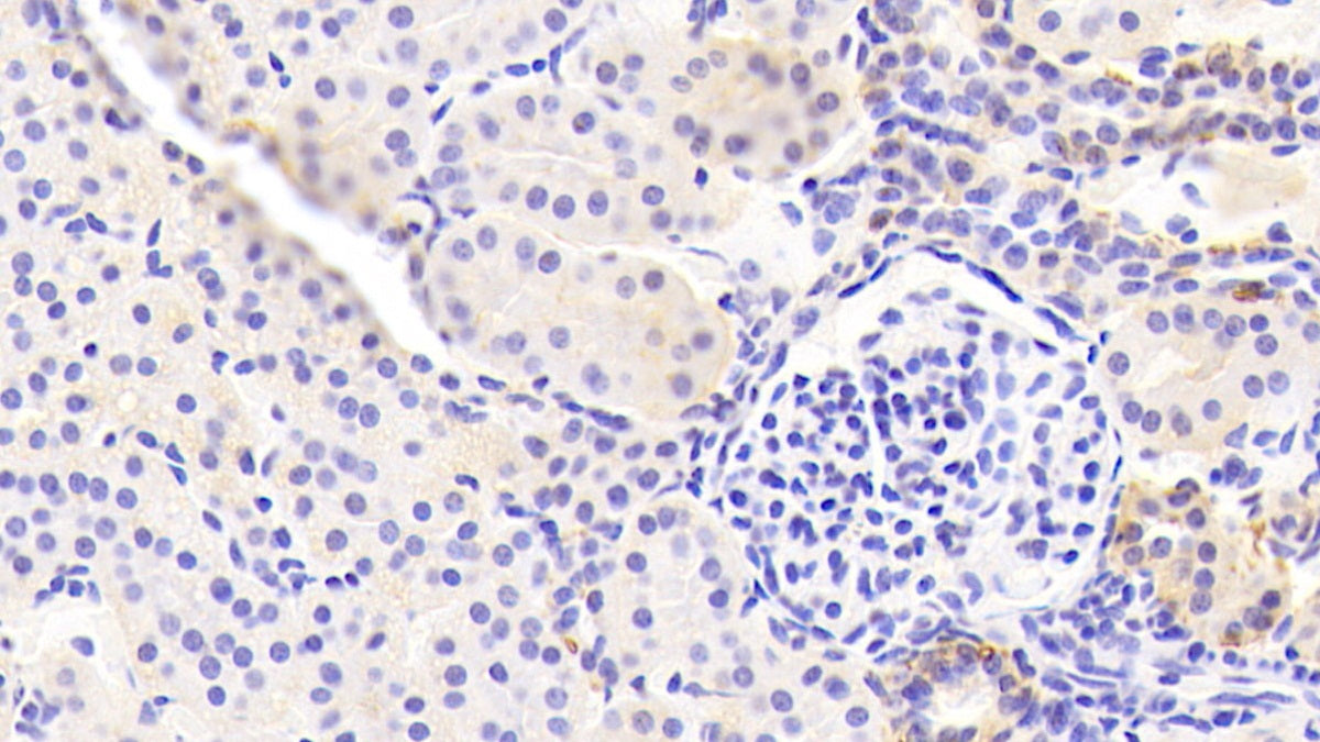 DAB staining on IHC-P; Samples: Porcine Small intestine Tissue; Primary Ab: 10μg/ml Rabbit Anti-Porcine EPCAM Antibody Second Ab: 2µg/mL HRP-Linked Caprine Anti-Rabbit IgG Polyclonal Antibody