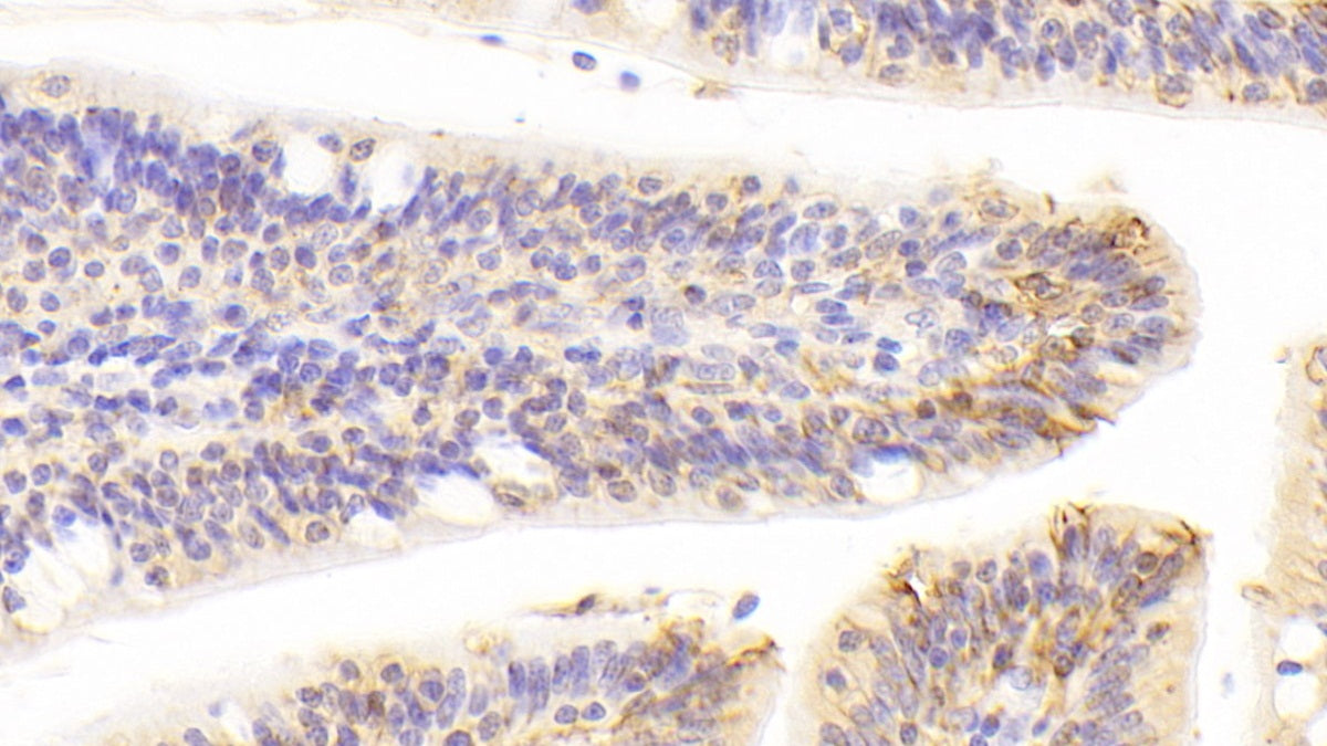 Epithelial Cell Adhesion Molecule (EPCAM) Polyclonal Antibody - image 4