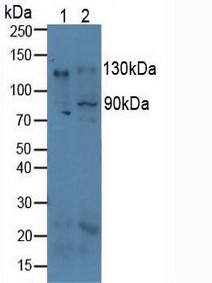 Western Blot; Sample: Lane1: A549 cell lysate; Lane2: Hela cell lysate; Lane3: MCF7 cell lysate; Primary Ab: 2µg/ml Rabbit Anti-Mouse ITGaV Antibody; Second Ab: 0.2µg/mL HRP-Linked Caprine Anti-Rabbit IgG Polyclonal Antibody;