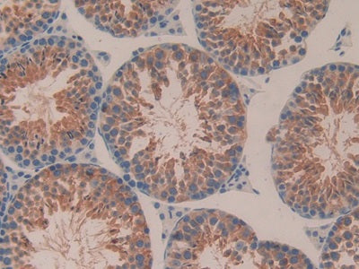 Integrin Alpha V (ITGaV) Polyclonal Antibody - image 5