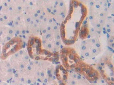 DAB staining on IHC-P; Samples: Rat Spleen Tissue