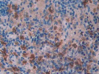 Cathepsin D (CTSD) Polyclonal Antibody - image 4