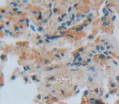 Fc Fragment Of IgG Low Affinity IIIa Receptor (FcgR3A) Polyclonal Antibody - image 4