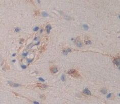 Fatty Acid Binding Protein 7, Brain (FABP7) Polyclonal Antibody - image 4