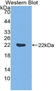 Down Regulator Of Transcription 1, TBP Binding (DR1) Polyclonal Antibody - image 2