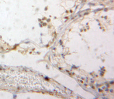 Down Regulator Of Transcription 1, TBP Binding (DR1) Polyclonal Antibody - image 3
