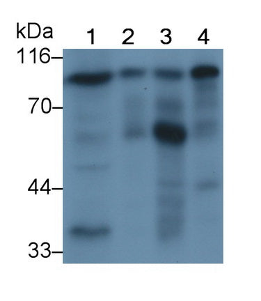 Angiostatin (ANG) Polyclonal Antibody - image 2
