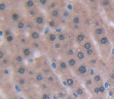 Angiostatin (ANG) Polyclonal Antibody - image 3