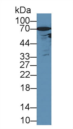 Western Blot; Sample: Recombinant protein.