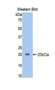 Androgen Receptor (AR) Polyclonal Antibody - image 3