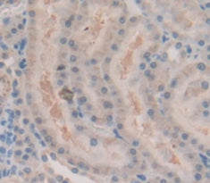 Androgen Receptor (AR) Polyclonal Antibody - image 4