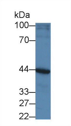 Western Blot; Sample: Recombinant protein.