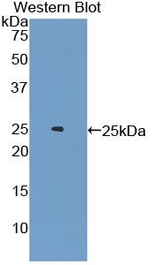 DAB staining on IHC-P; Samples: Rat Ovary Tissue;  Primary Ab: 10µg/ml Rabbit Anti-Rat AR Antibody Second Ab: 2µg/mL HRP-Linked Caprine Anti-Rabbit IgG Polyclonal Antibody