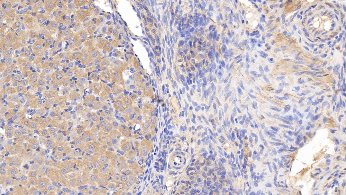 Androgen Receptor (AR) Polyclonal Antibody - image 4
