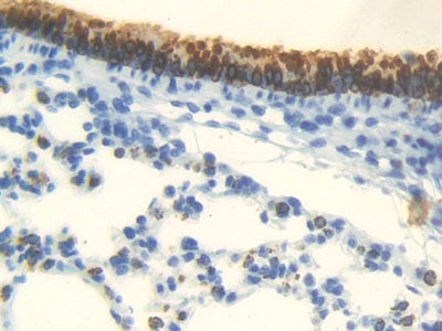 DAB staining on IHC-P; Samples: Mouse Lung Tissue