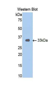 Androgen Receptor (AR) Polyclonal Antibody - image 2