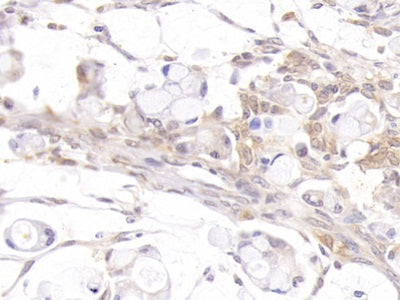Androgen Receptor (AR) Polyclonal Antibody - image 4