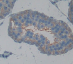 Tumor Necrosis Factor Receptor Superfamily, Member 5 (CD40) Polyclonal Antibody - image 3