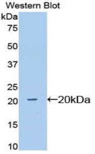 Sialic Acid Binding Ig Like Lectin 12 (SIGLEC12) Polyclonal Antibody - image 2