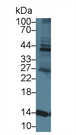 Western Blot; Sample: Recombinant protein.