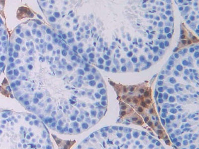 DAB staining on fromalin fixed paraffin- embedded kidney tissue)