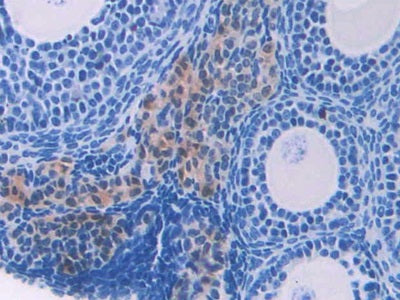 Heart-type Fatty Acid Binding Protein (H-FABP) Polyclonal Antibody - image 5