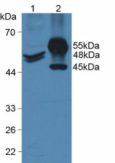 Western Blot; Sample: Recombinant KRT20, Human.