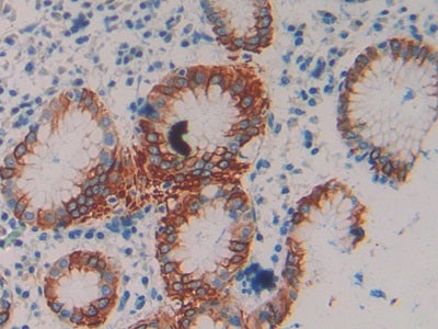 DAB staining on IHC-P; Samples: Human Stomach Tissue