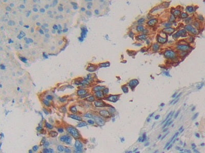 Cytokeratin 20 (CK 20) Polyclonal Antibody - image 5